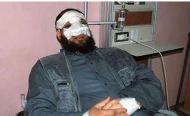 Μια ρινοπλαστική επέμβαση προκάλεσε την παραίτηση ισλαμιστή βουλευτή στην Αίγυπτο